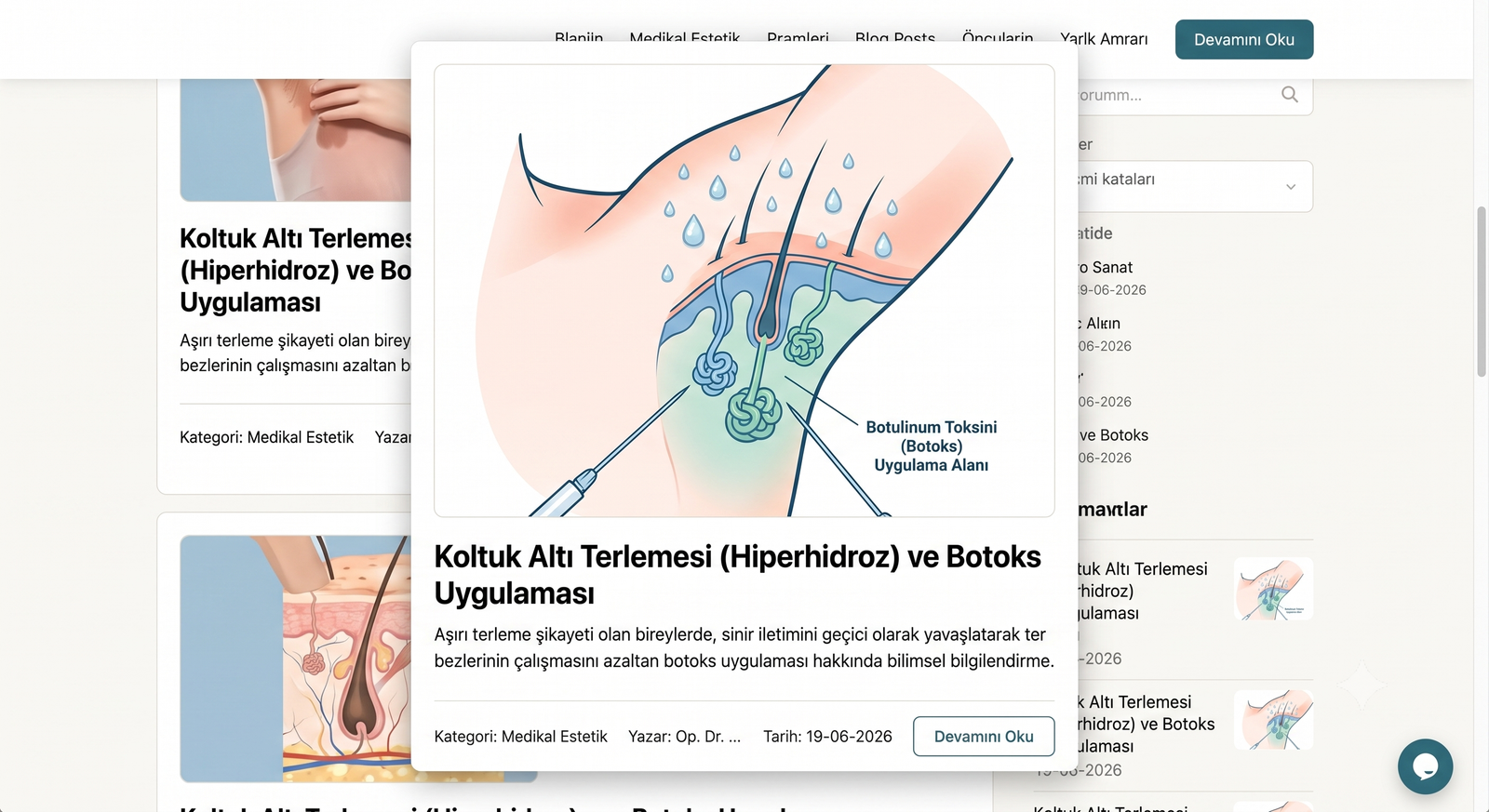 Koltuk Altı Terlemesi (Hiperhidroz) ve Botoks Uygulaması